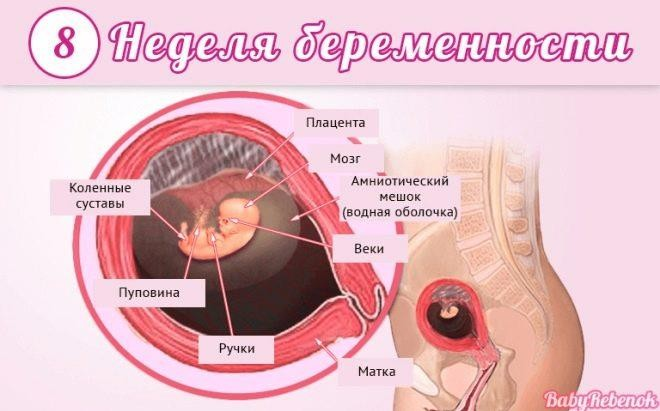 Выкидыш, как избежать